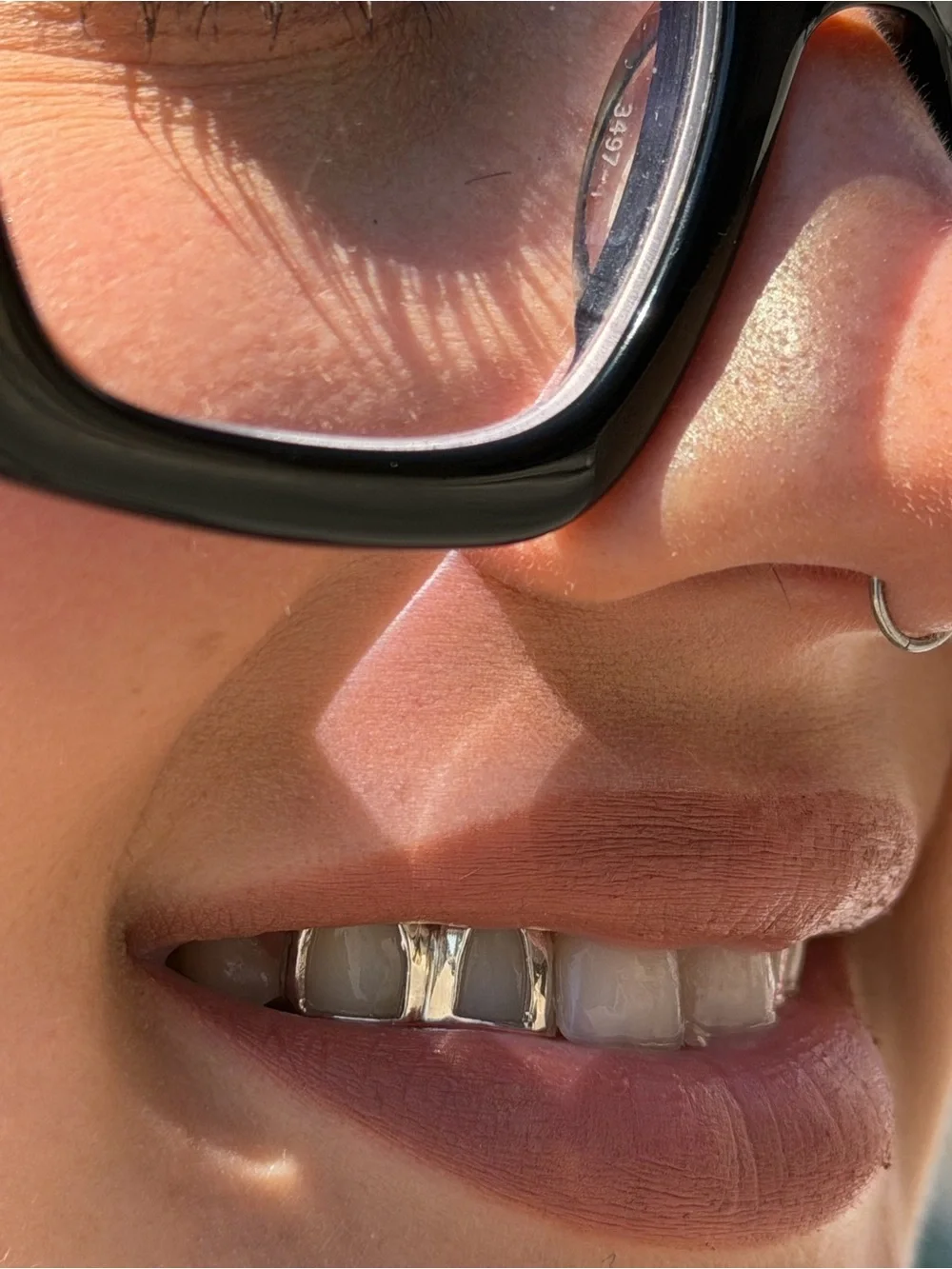 Custom Grillz Mold Kit – Start Your Custom Grillz Order – $150 Deposit